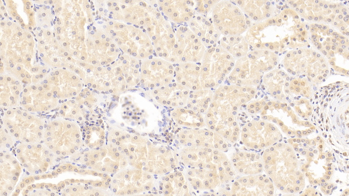 Monoclonal Antibody to Interleukin 18 (IL18)