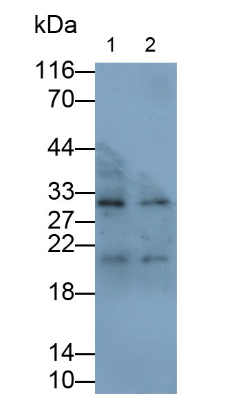 Monoclonal Antibody to Interleukin 18 (IL18)