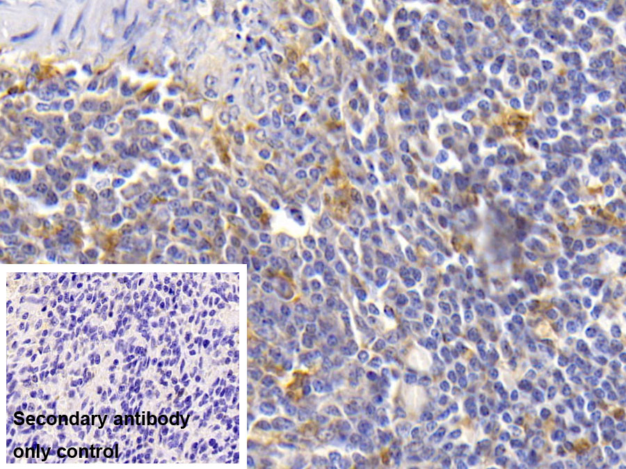 Monoclonal Antibody to Interleukin 18 (IL18)