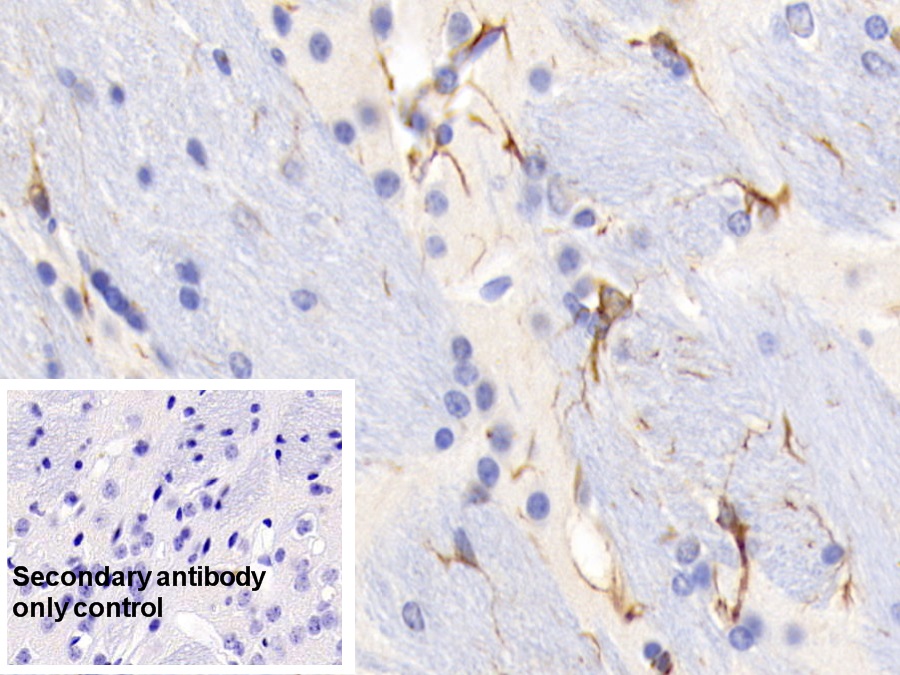 Monoclonal Antibody to Glial Fibrillary Acidic Protein (GFAP)