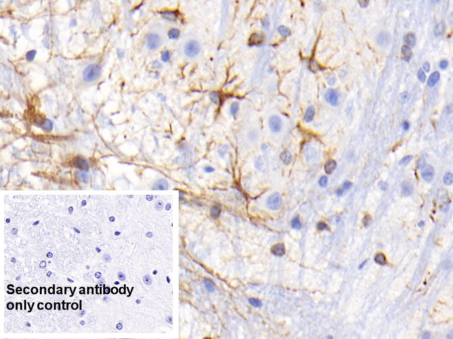 Monoclonal Antibody to Glial Fibrillary Acidic Protein (GFAP)