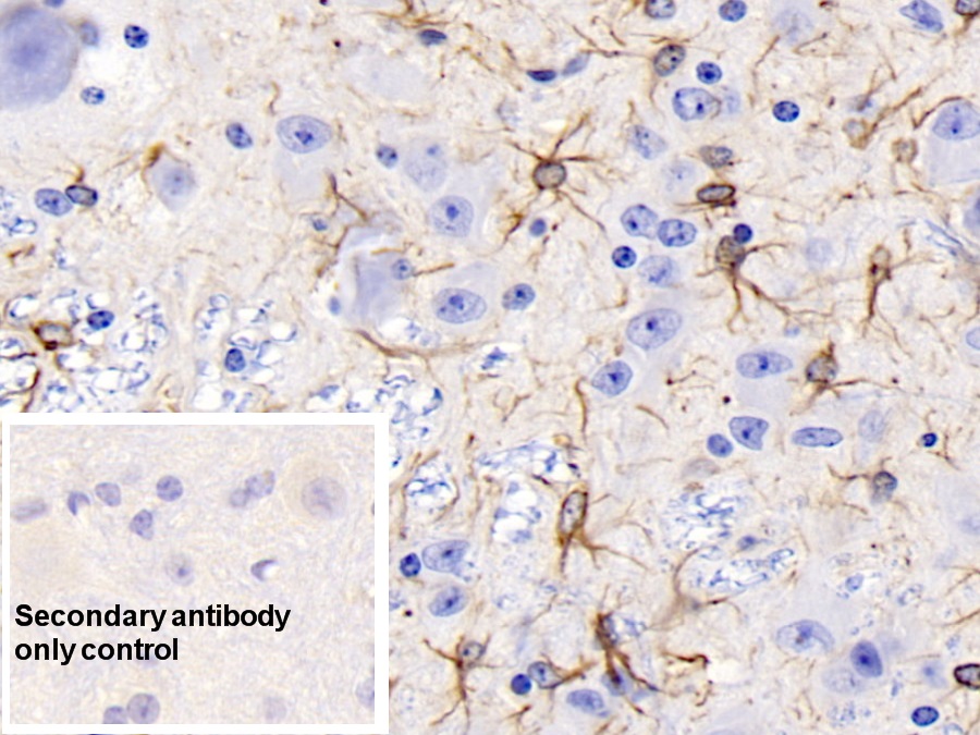 Monoclonal Antibody to Glial Fibrillary Acidic Protein (GFAP)