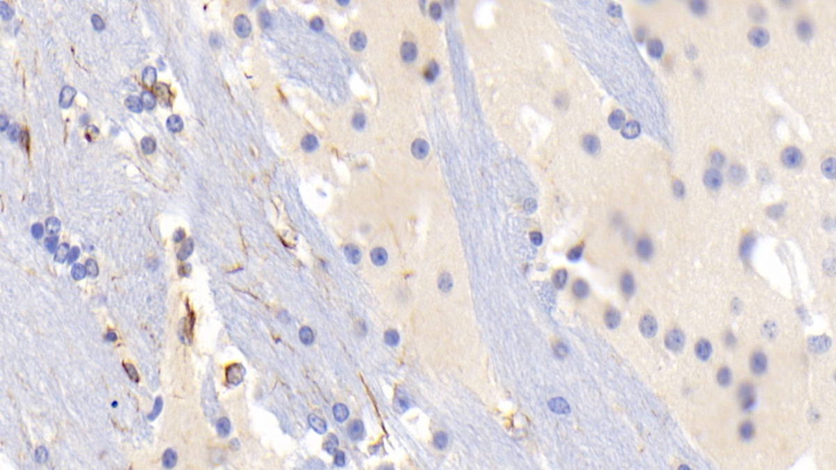 Monoclonal Antibody to Glial Fibrillary Acidic Protein (GFAP)