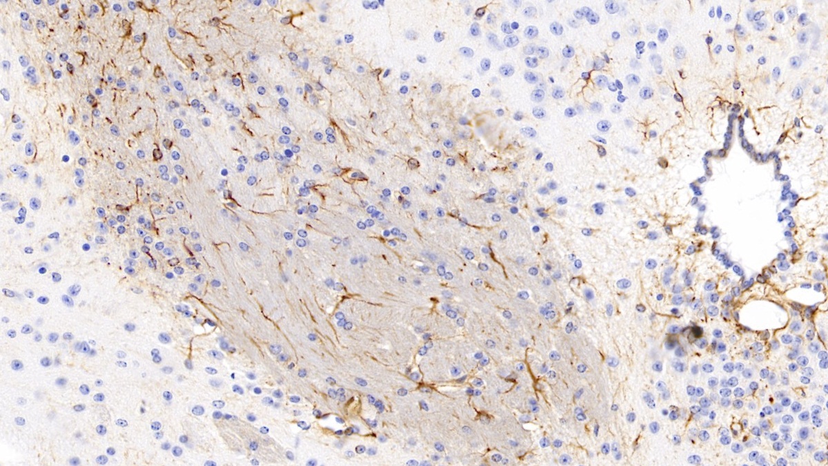 Monoclonal Antibody to Glial Fibrillary Acidic Protein (GFAP)