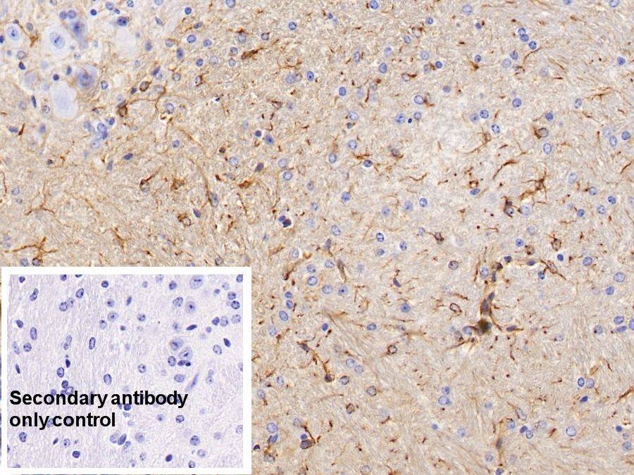 Monoclonal Antibody to Glial Fibrillary Acidic Protein (GFAP)