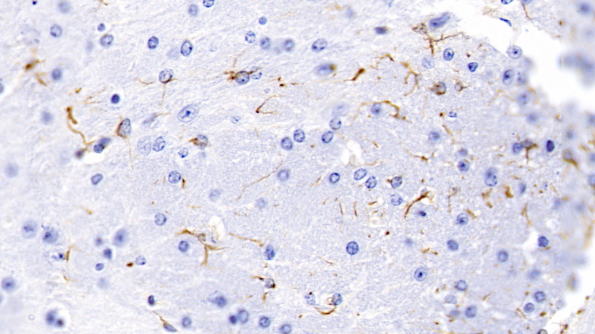 Monoclonal Antibody to Glial Fibrillary Acidic Protein (GFAP)