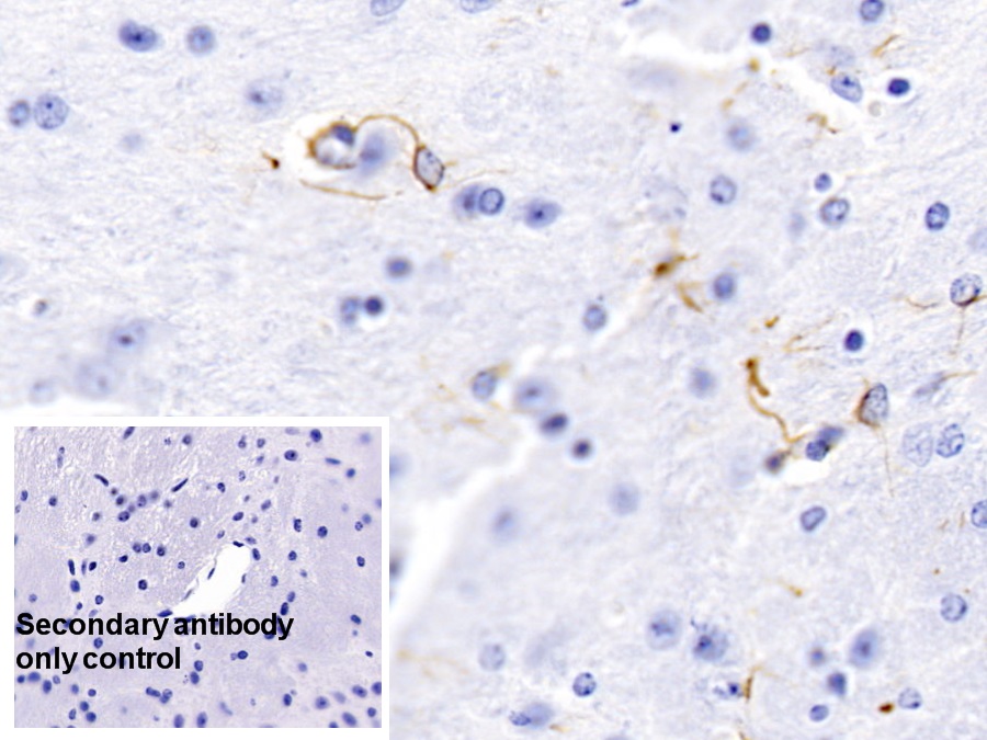 Monoclonal Antibody to Glial Fibrillary Acidic Protein (GFAP)