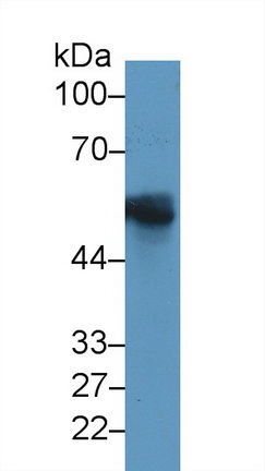 Monoclonal Antibody to Glial Fibrillary Acidic Protein (GFAP)