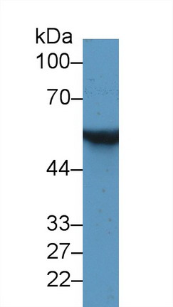 Monoclonal Antibody to Glial Fibrillary Acidic Protein (GFAP)