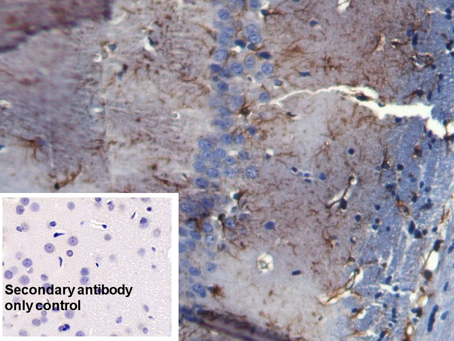 Monoclonal Antibody to Glial Fibrillary Acidic Protein (GFAP)