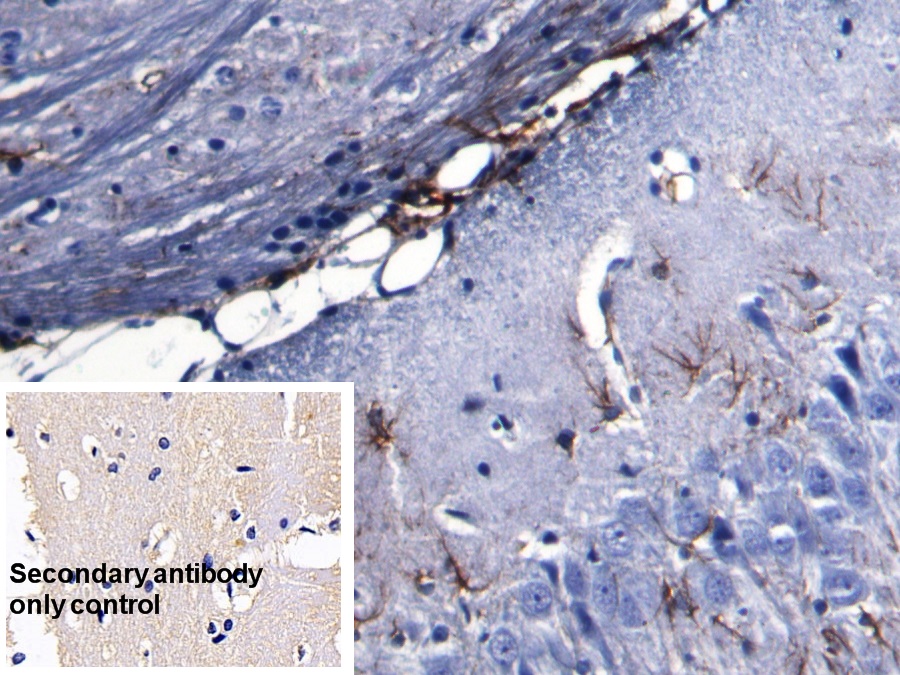 Monoclonal Antibody to Glial Fibrillary Acidic Protein (GFAP)