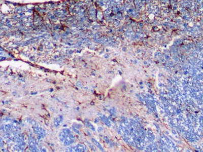 Monoclonal Antibody to Glial Fibrillary Acidic Protein (GFAP)