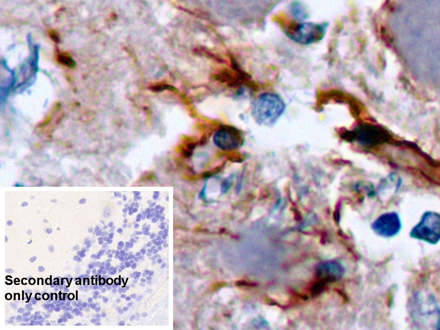 Monoclonal Antibody to Glial Fibrillary Acidic Protein (GFAP)