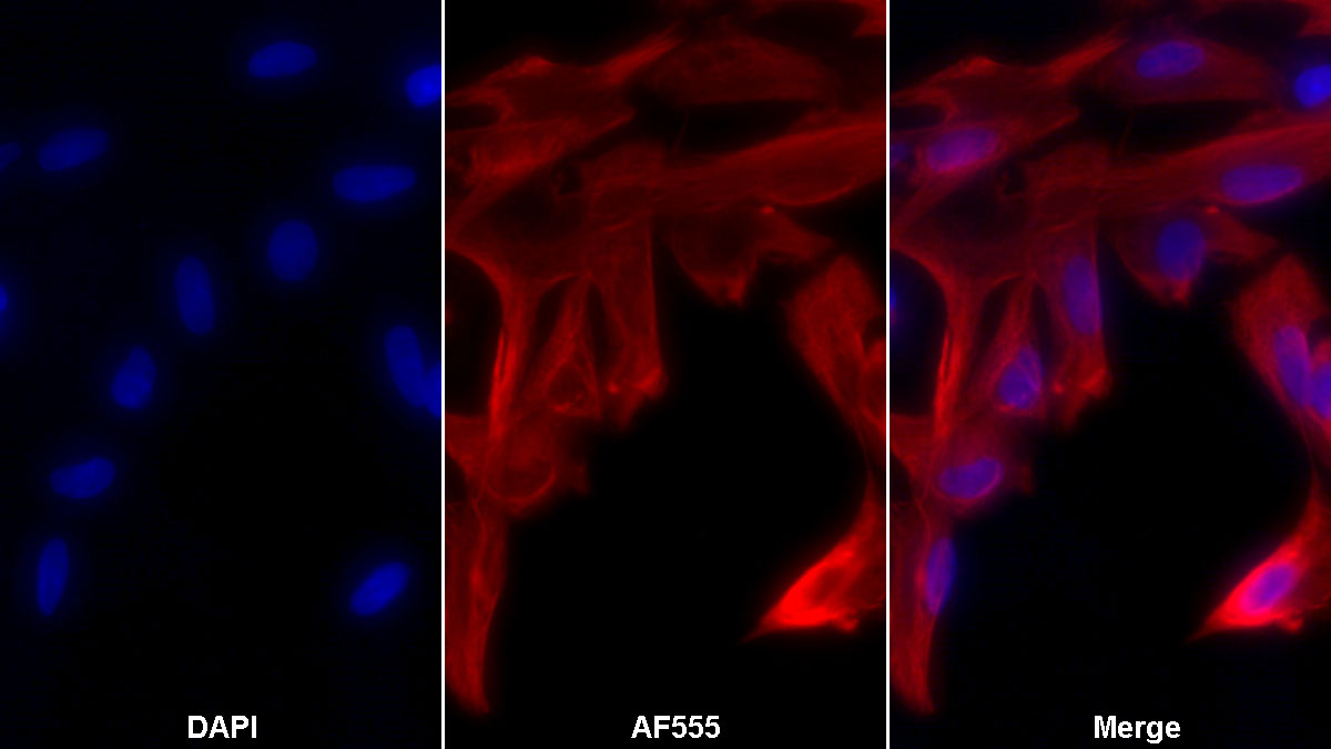 Monoclonal Antibody to Glial Fibrillary Acidic Protein (GFAP)