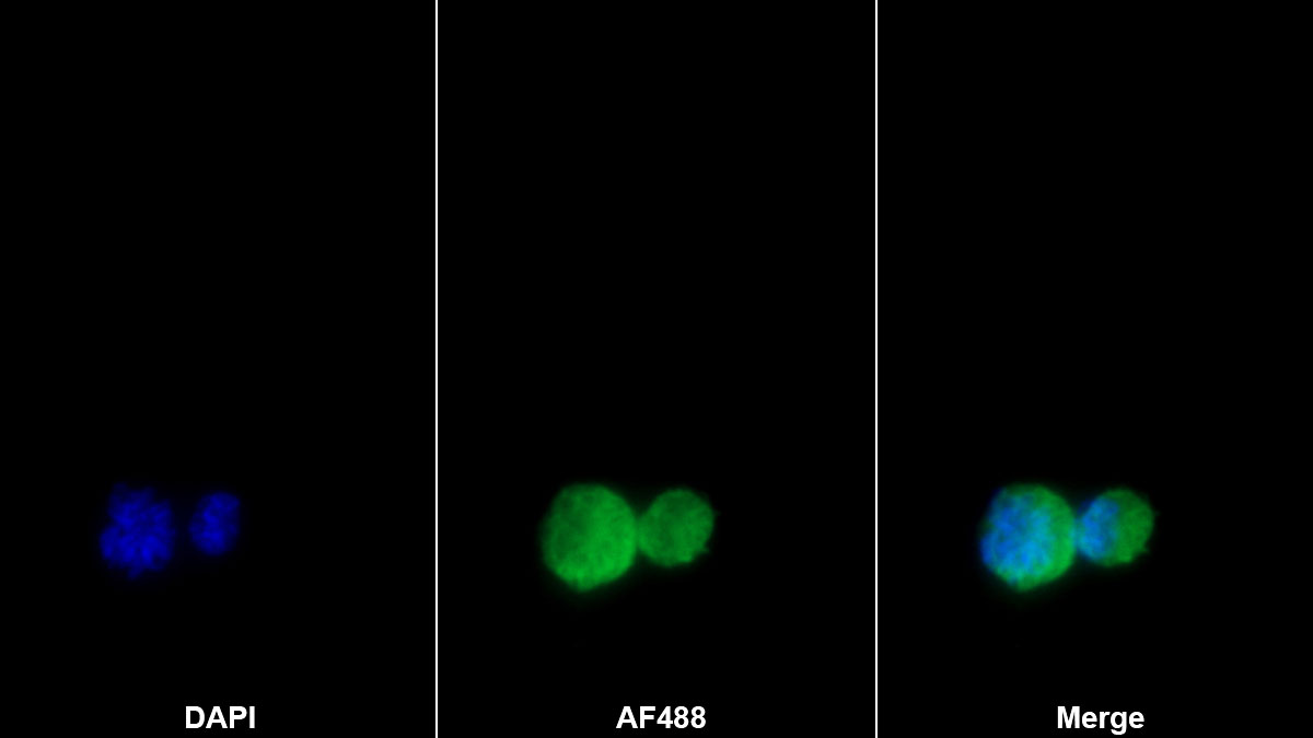 Monoclonal Antibody to Interleukin 1 Alpha (IL1a)