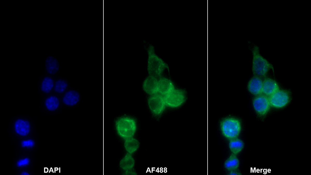 Monoclonal Antibody to Interleukin 1 Alpha (IL1a)