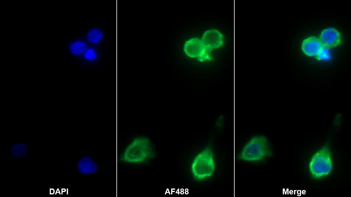 Monoclonal Antibody to Interleukin 1 Alpha (IL1a)