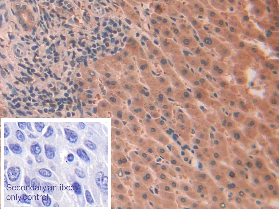 Monoclonal Antibody to Interleukin 1 Alpha (IL1a)