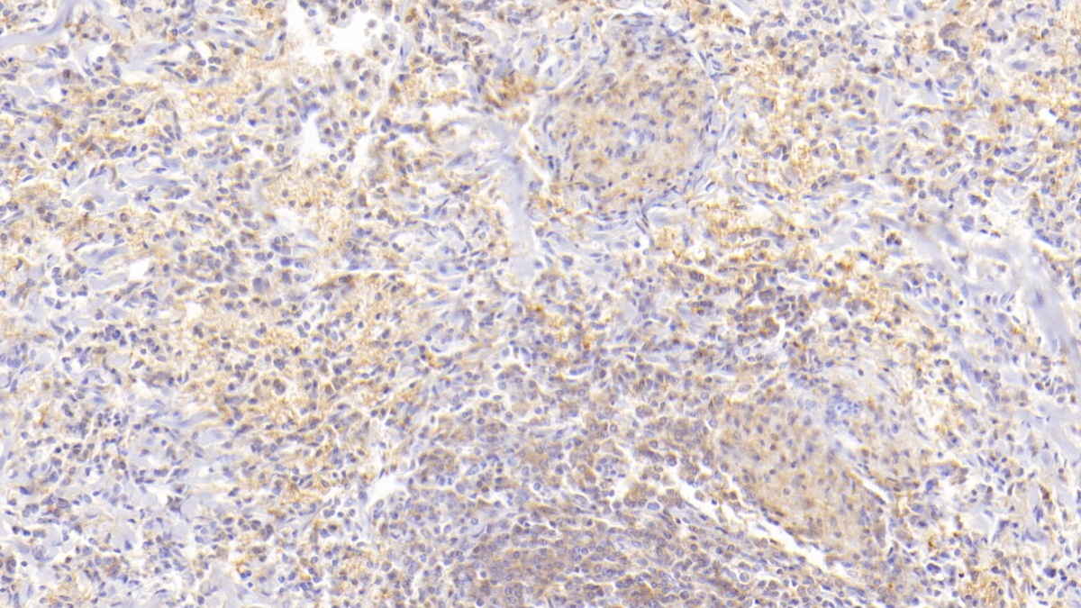 Monoclonal Antibody to Interleukin 2 (IL2)