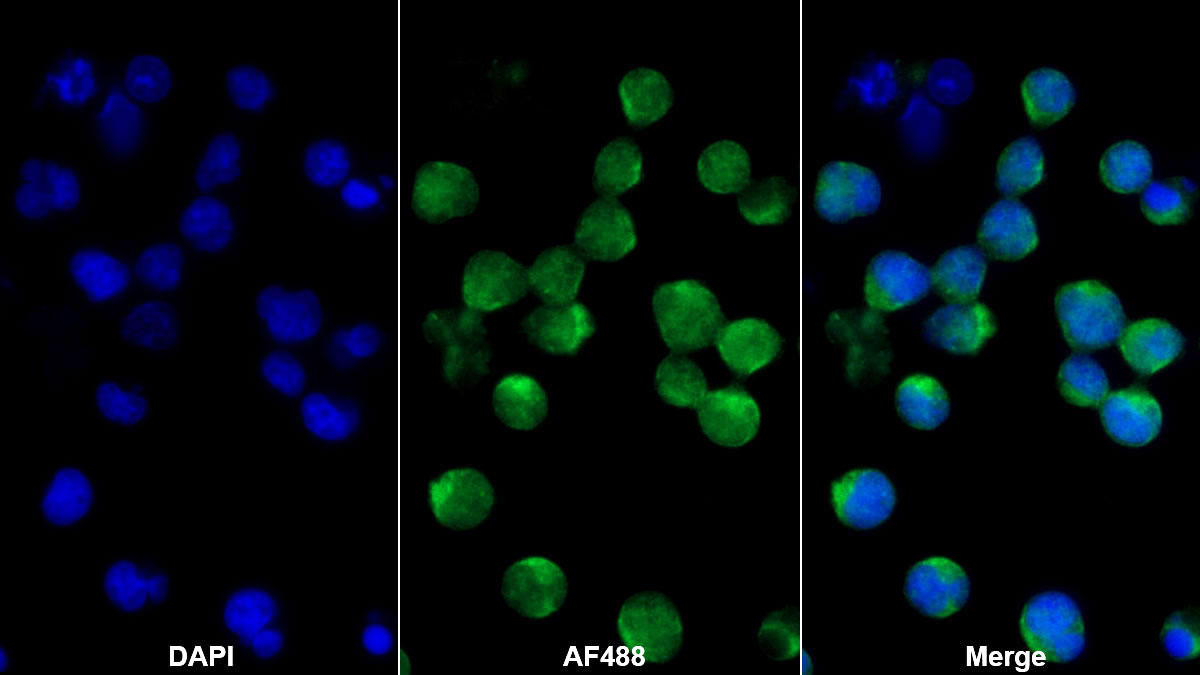 Monoclonal Antibody to Interleukin 3 (IL3)