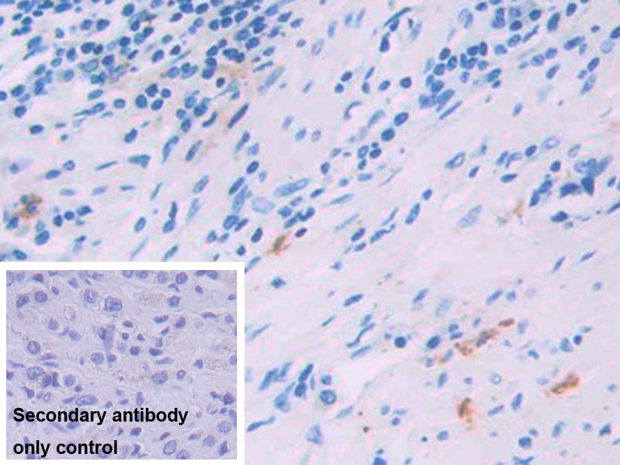 Monoclonal Antibody to Interleukin 4 (IL4)