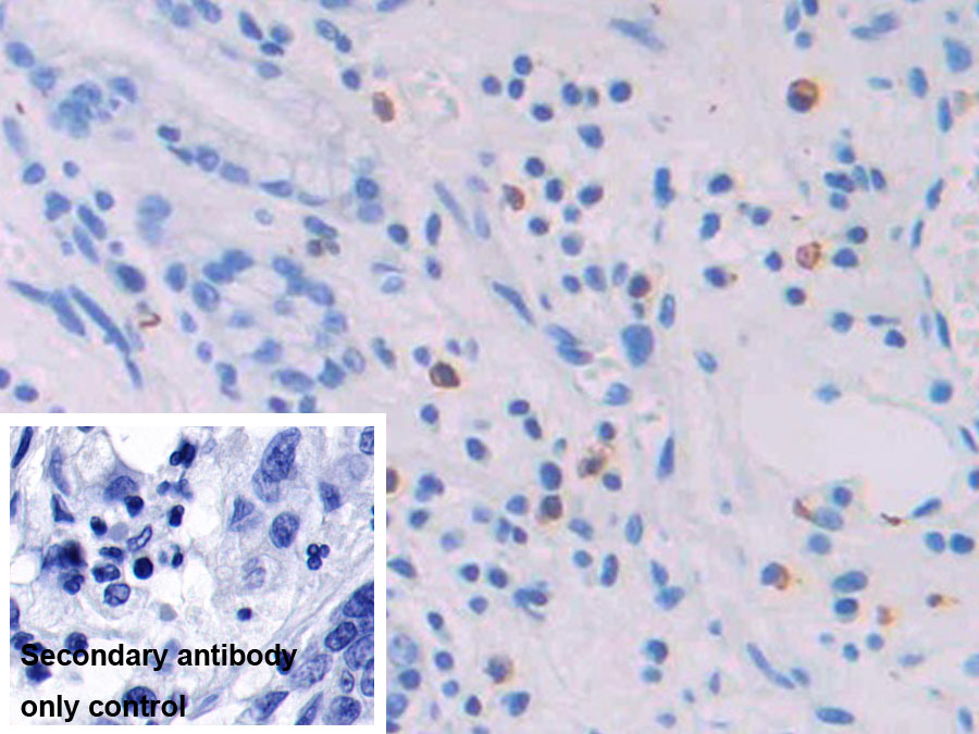 Monoclonal Antibody to Interleukin 4 (IL4)