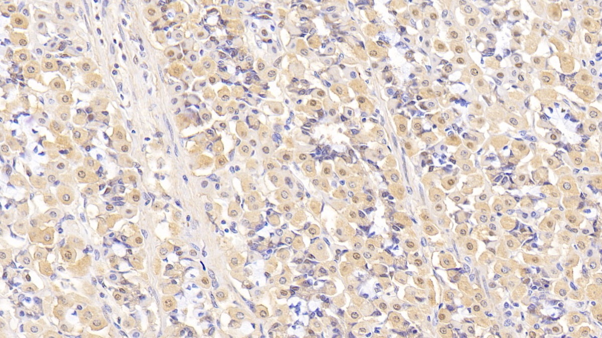 Monoclonal Antibody to Interleukin 5 (IL5)