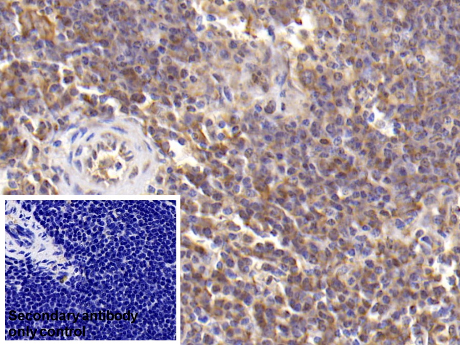 Monoclonal Antibody to Interleukin 6 (IL6)