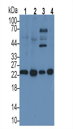 Monoclonal Antibody to Interleukin 6 (IL6)