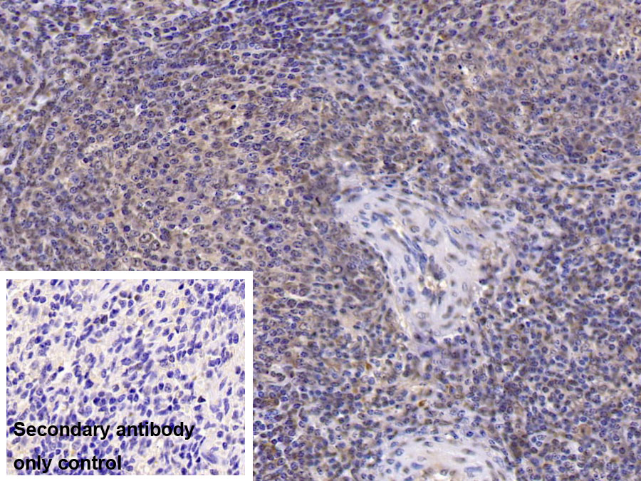 Monoclonal Antibody to Interleukin 6 (IL6)