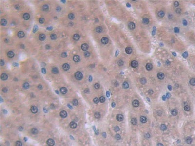 Monoclonal Antibody to Interleukin 6 (IL6)