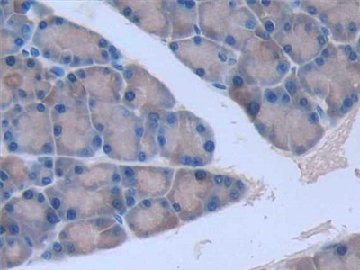 Monoclonal Antibody to Interleukin 6 (IL6)