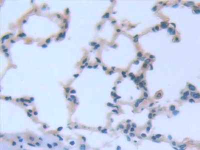 Monoclonal Antibody to Interleukin 6 (IL6)