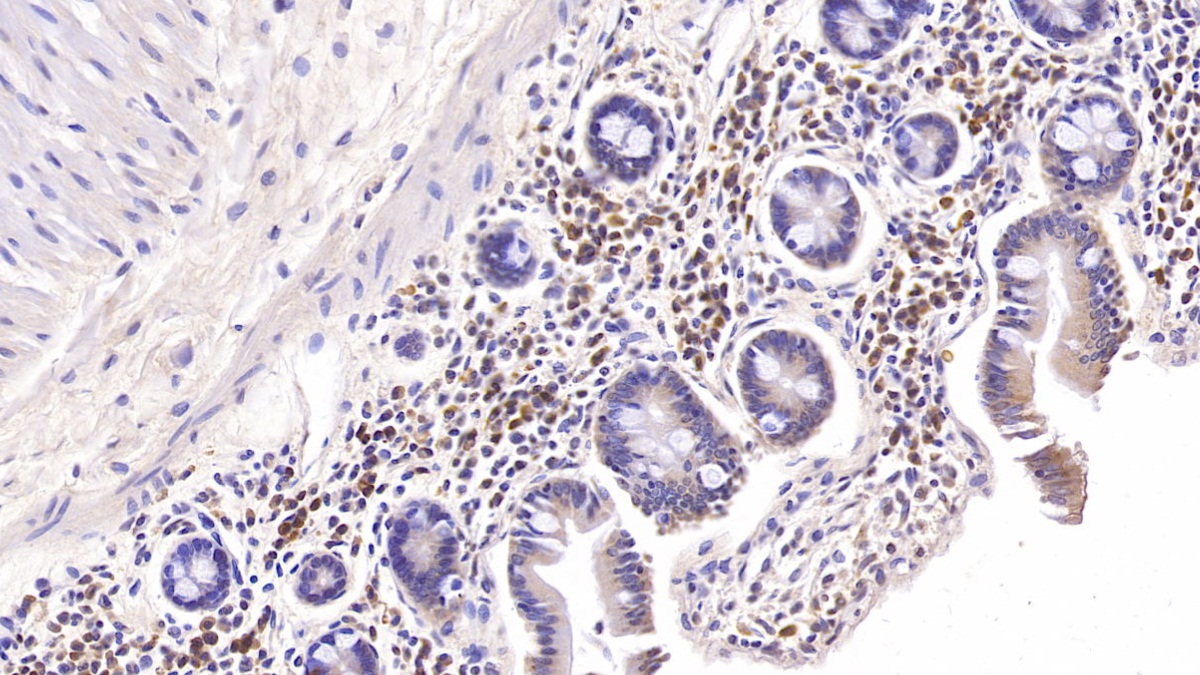 Monoclonal Antibody to Interleukin 6 (IL6)