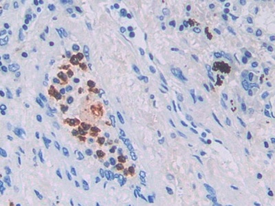 Monoclonal Antibody to Interleukin 6 (IL6)