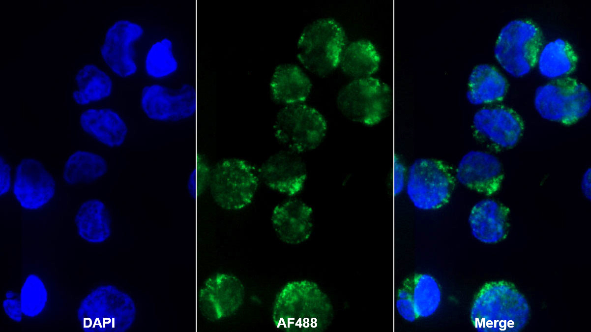 Monoclonal Antibody to Interleukin 8 (IL8)