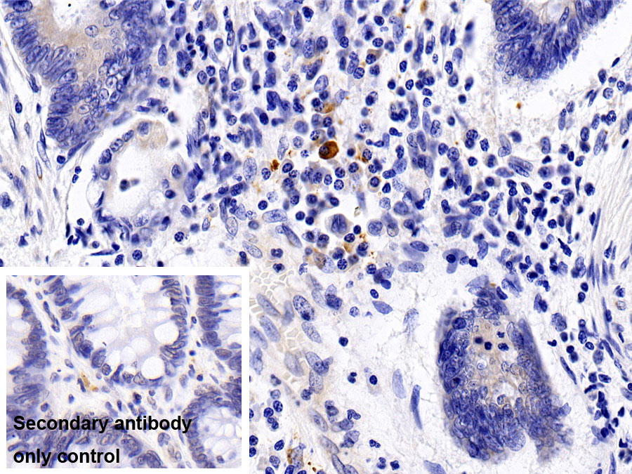 Monoclonal Antibody to Interleukin 8 (IL8)