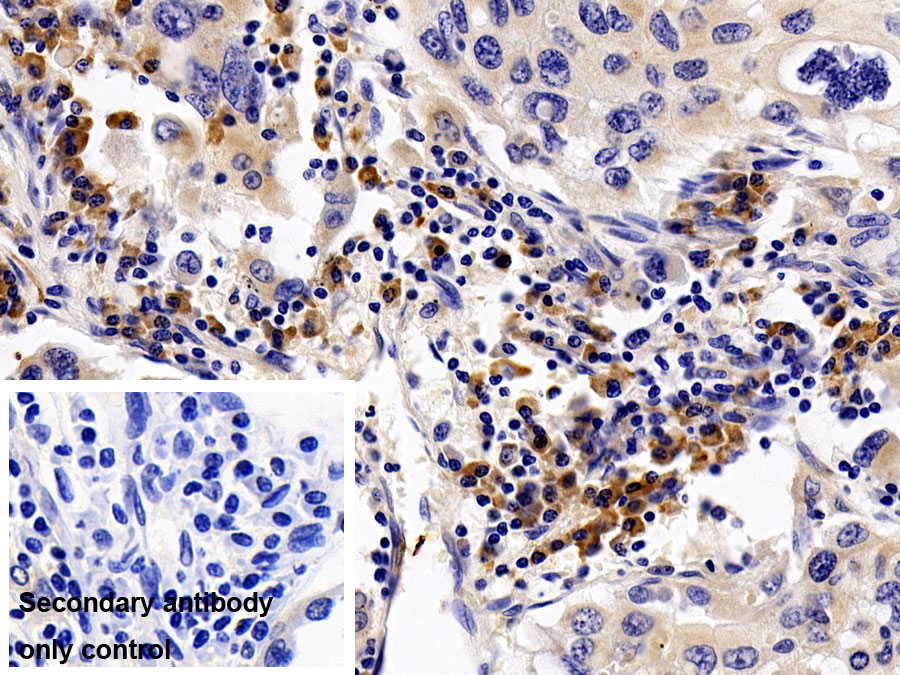 Monoclonal Antibody to Interleukin 8 (IL8)