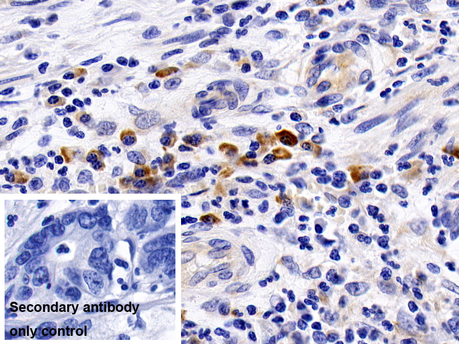 Monoclonal Antibody to Interleukin 8 (IL8)