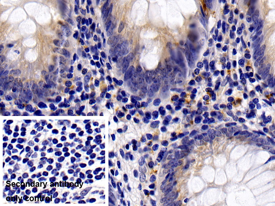 Monoclonal Antibody to Interleukin 8 (IL8)