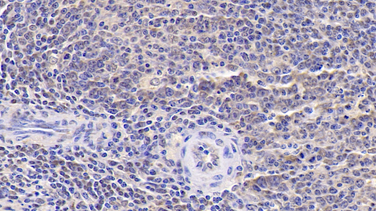 Monoclonal Antibody to Interleukin 9 (IL9)