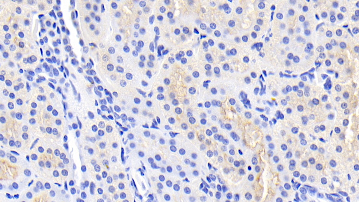 Monoclonal Antibody to Leptin (LEP)