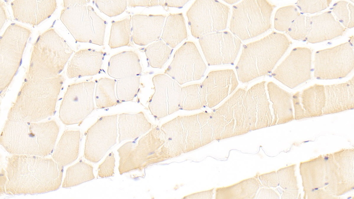 Monoclonal Antibody to Leukemia Inhibitory Factor (LIF)