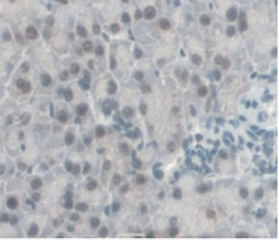 Monoclonal Antibody to Monocyte Chemotactic Protein 1 (MCP1)