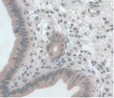 Monoclonal Antibody to Monocyte Chemotactic Protein 1 (MCP1)