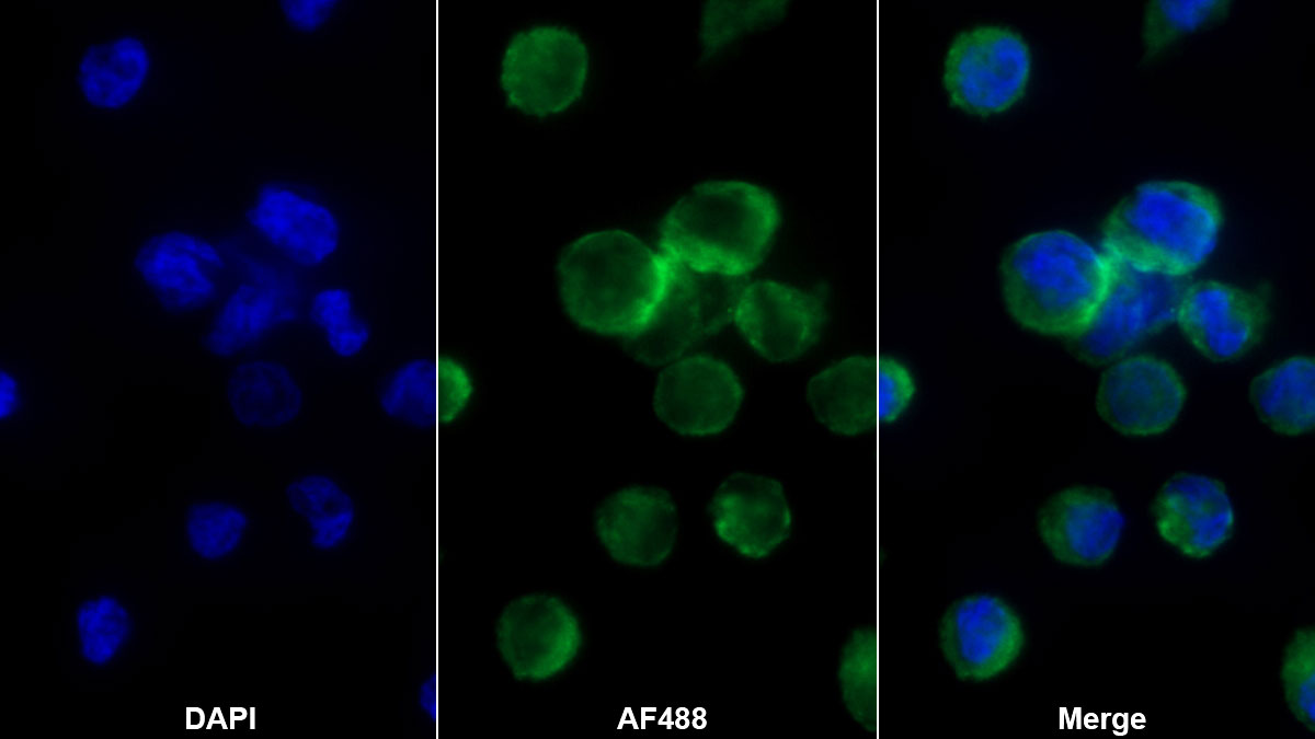 Monoclonal Antibody to Macrophage Derived Chemokine (MDC)