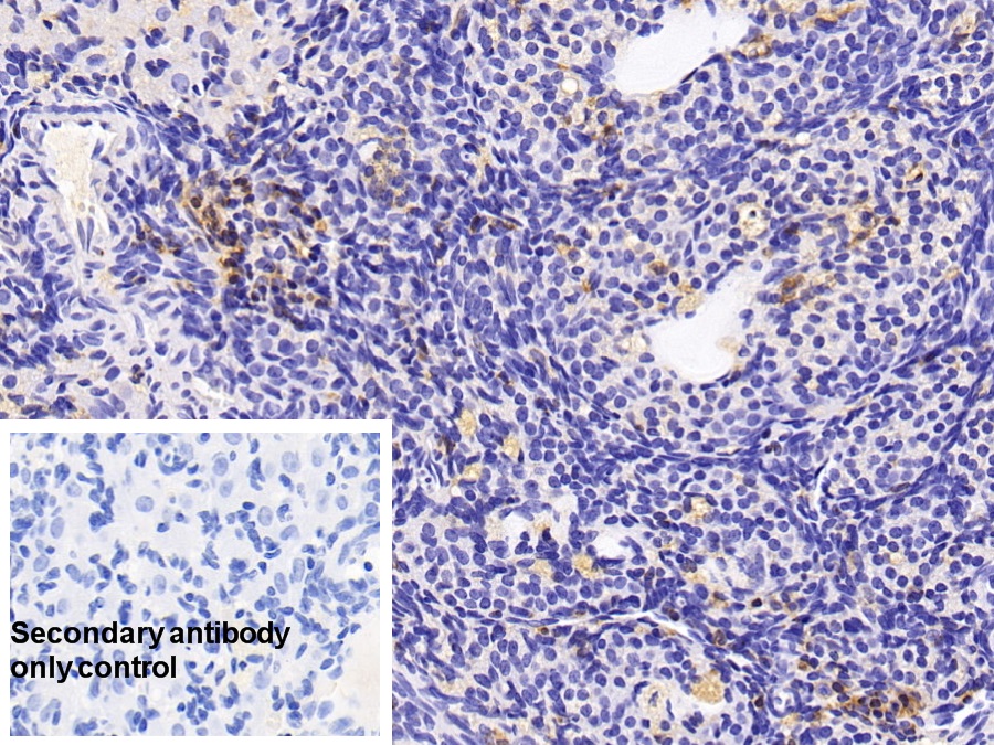 Monoclonal Antibody to Macrophage Inflammatory Protein 1 Alpha (MIP1a)