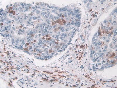 Monoclonal Antibody to Macrophage Inflammatory Protein 3 Alpha (MIP3a)