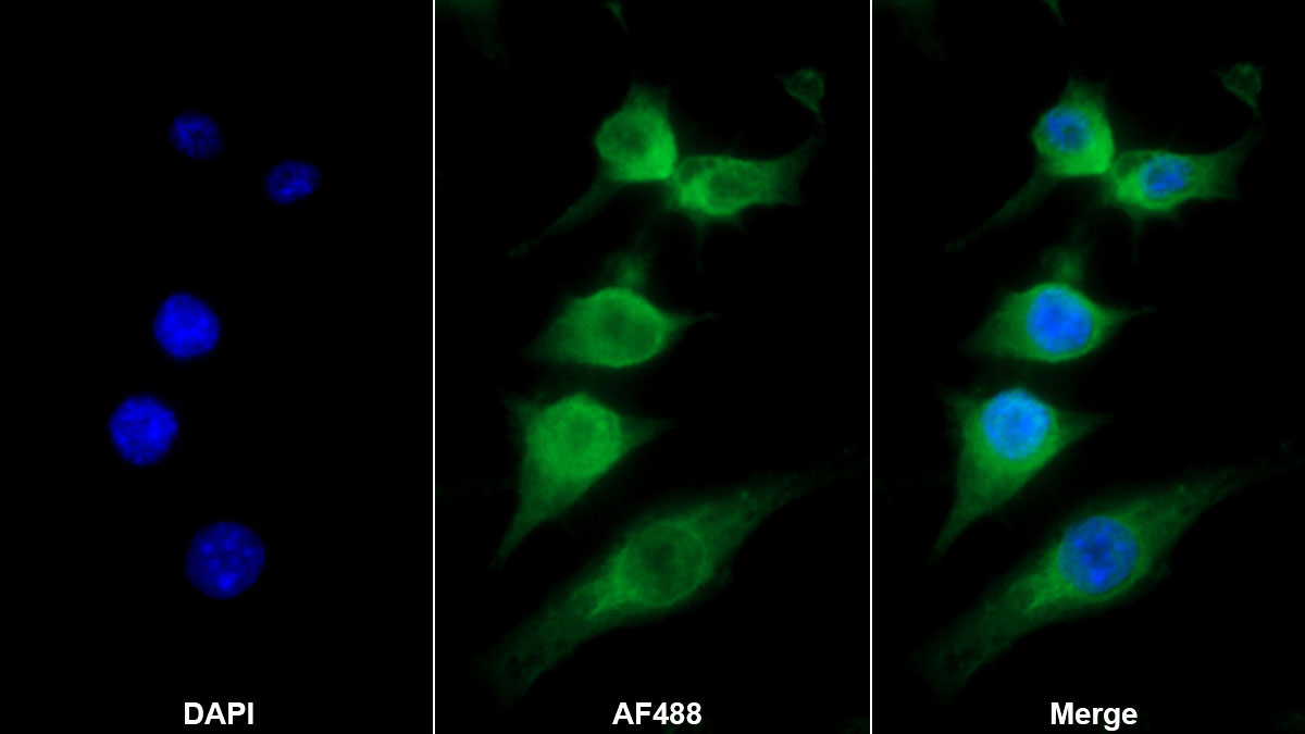 Monoclonal Antibody to Macrophage Inflammatory Protein 3 Alpha (MIP3a)