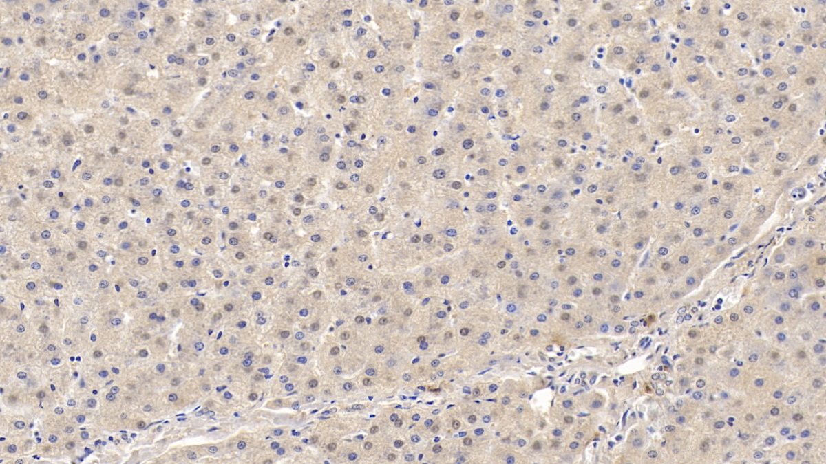 Monoclonal Antibody to Matrix Metalloproteinase 13 (MMP13)